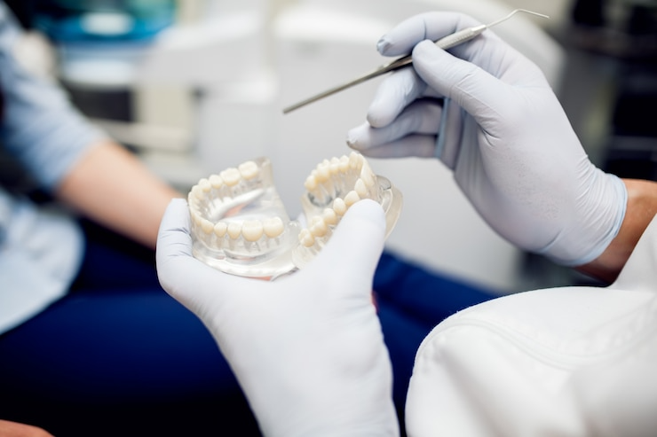 Best Dental Implant Doctor in Dilshad Garden