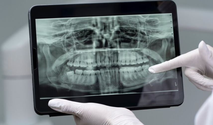 Best Digital Radiograph Hospital in Dilshad Garden