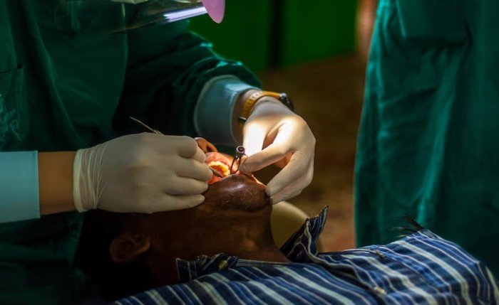 Best Extraction Surgeon in Dilshad Garden