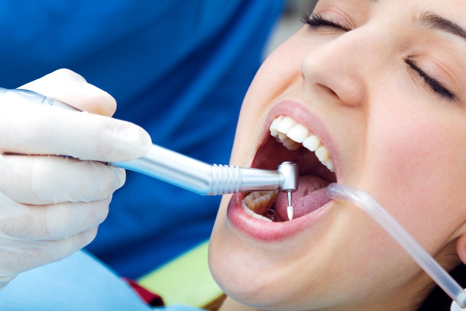 Best Dental Clinic for Teeth Cleaning in Dilshad Colony