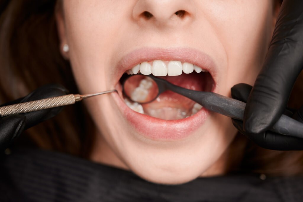 Best Tooth Restoration Hospital in East Delhi