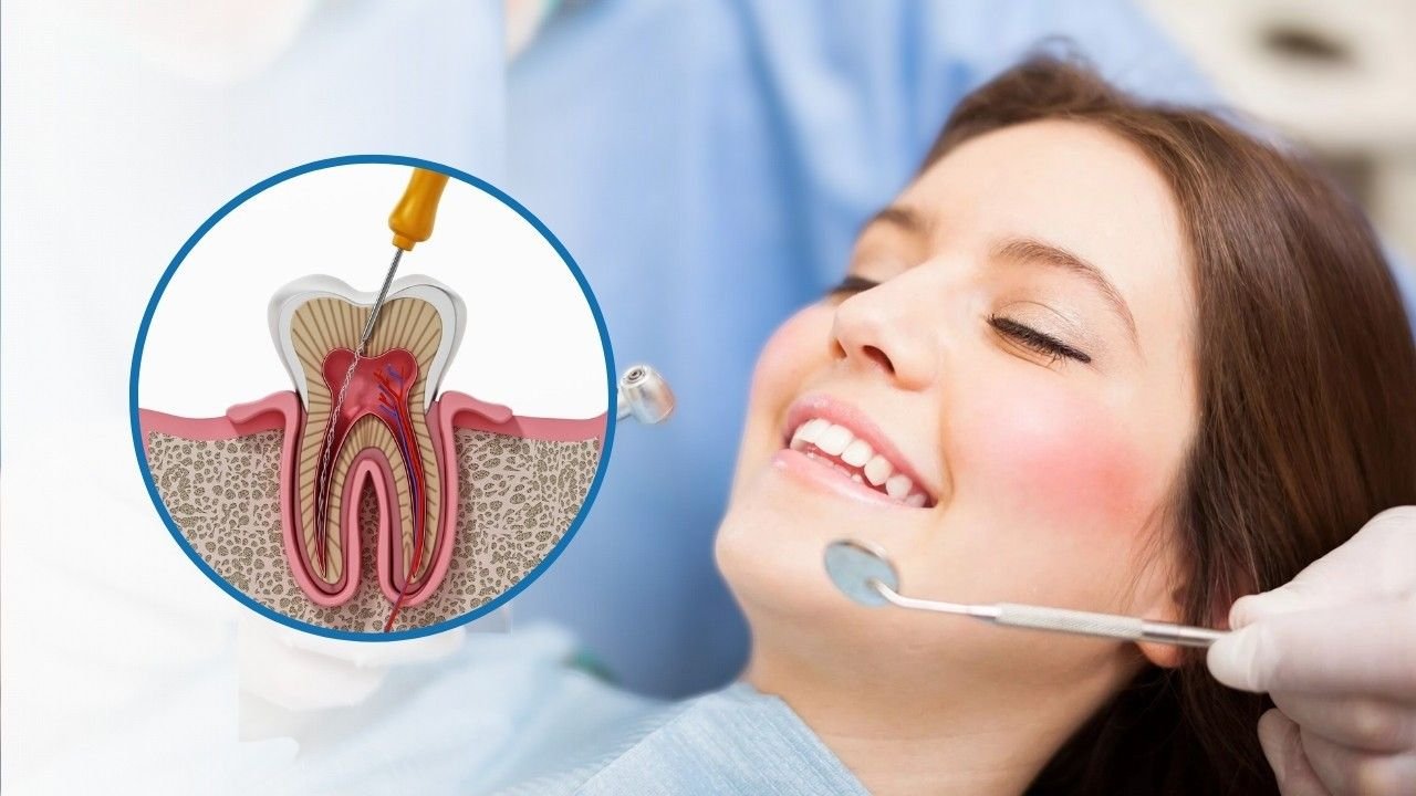 Best Root Canal Specialist in Delhi
